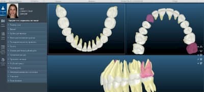 цифровая ортодонтия в стоматологии