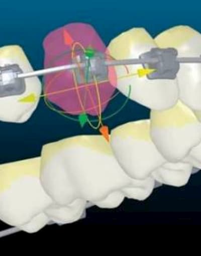 Цифровая ортодонтия в стоматологии асса