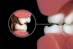 Гнатология-лечение в стоматологии АССА